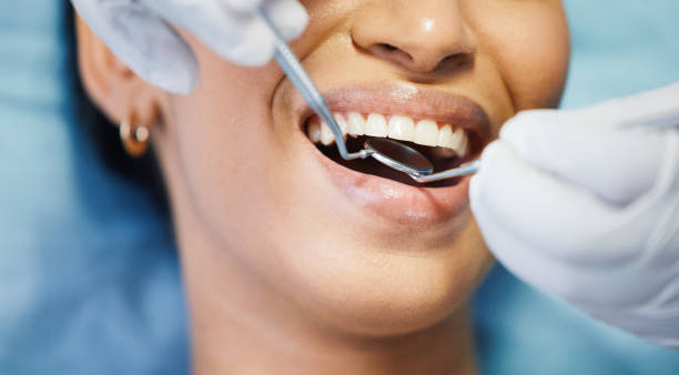 Best Emergency Tooth Extraction in Independence, VA